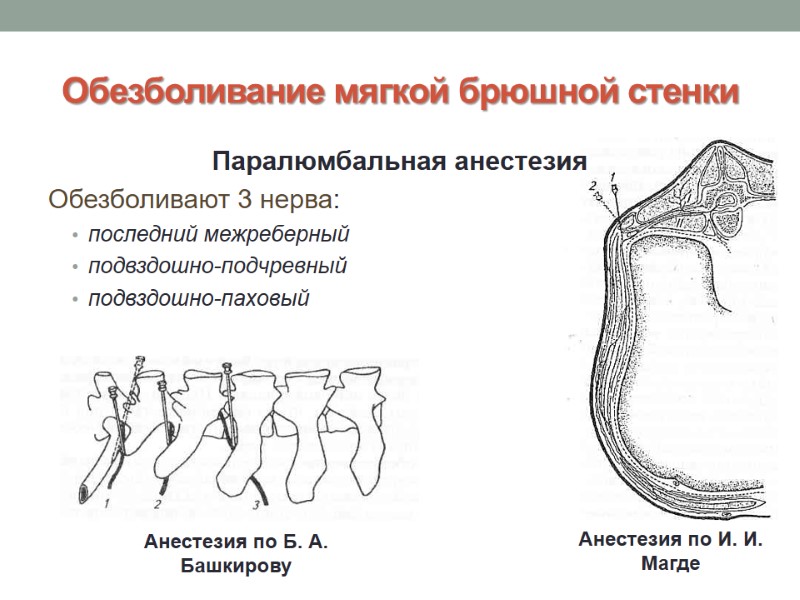 Обезболивание мягкой брюшной стенки Паралюмбальная анестезия  Обезболивают 3 нерва: последний межреберный  подвздошно-подчревный